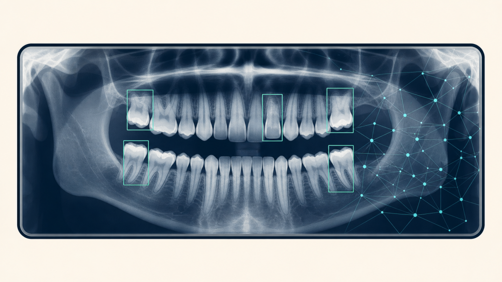 AI dental imaging analyzing an x-ray for bone levels
